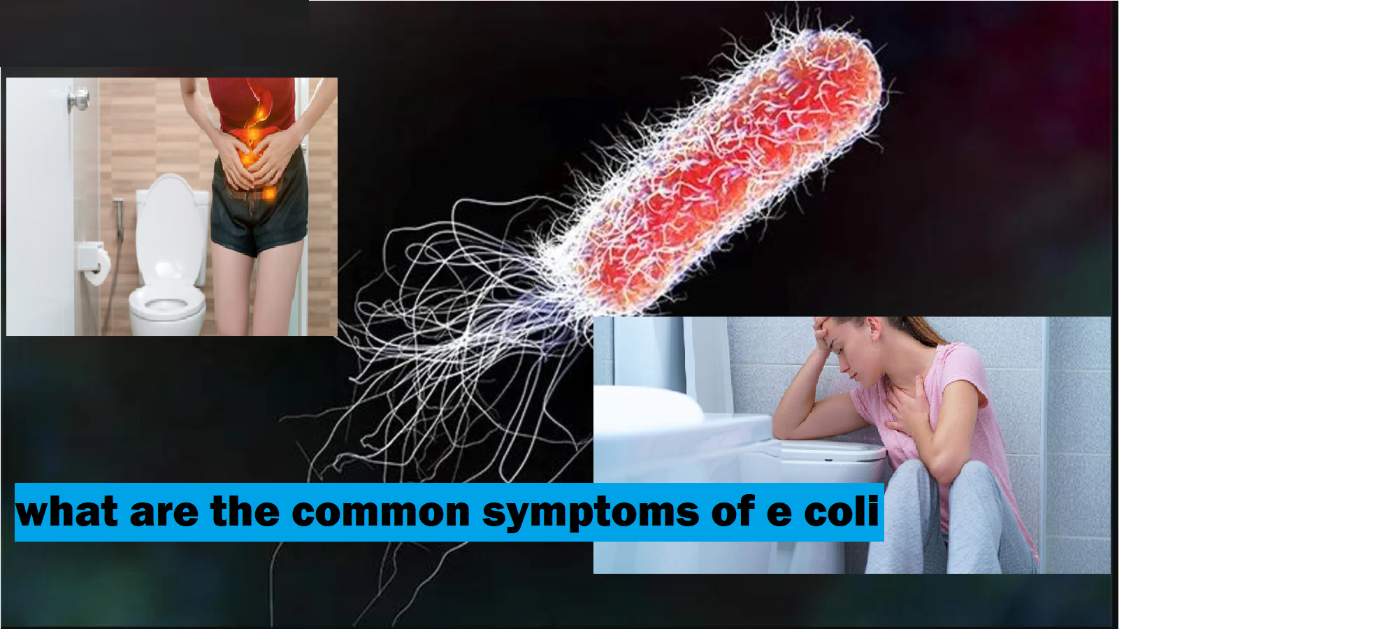 symptoms of e coli